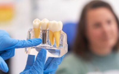 IMPLANTES DENTALES | Resolvemos tus dudas