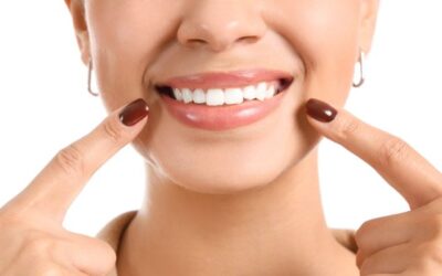 Carillas o Blanqueamiento Dental: cómo elegir el mejor tratamiento para lucir una sonrisa más blanca